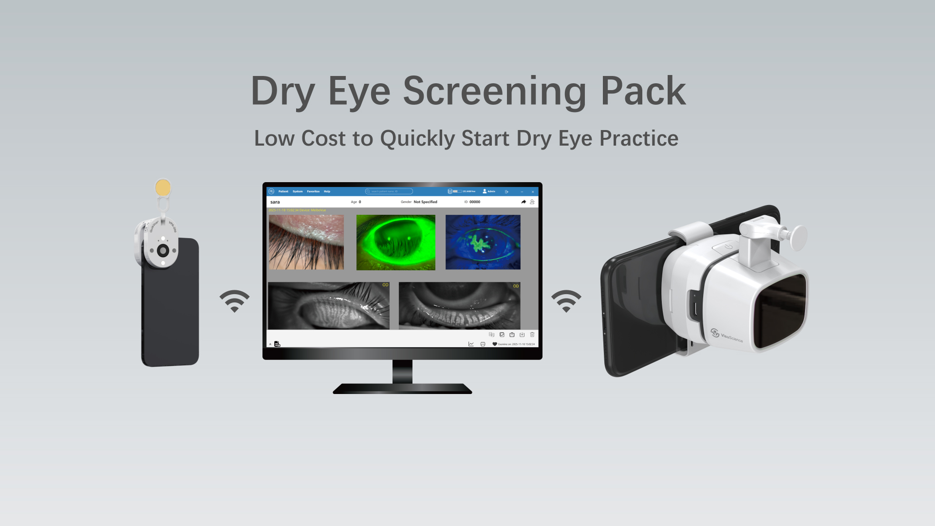 MeiboVue Dry Eye Screening Pack